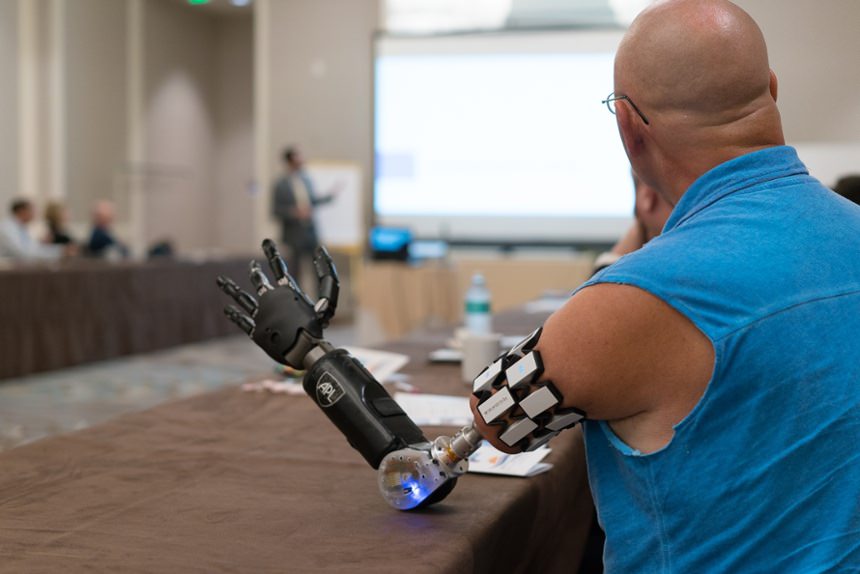 Prosthetic Technology | Arm Dynamics